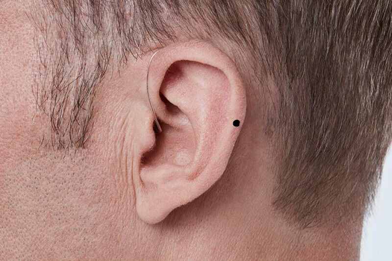 Nốt ruồi ở trên tai nói lên ý nghĩa gì?