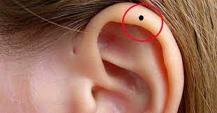 Nốt ruồi trên vành tai nam nữ nói về vận mệnh bạn ra sao?